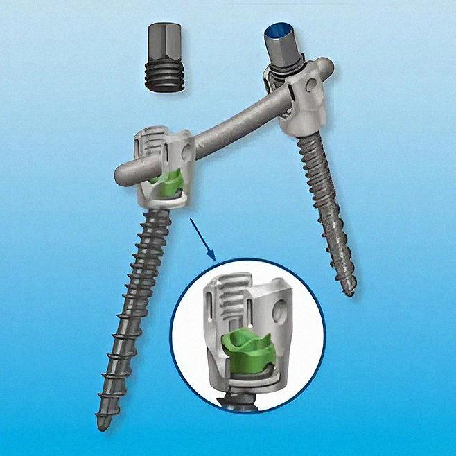 Система для транспедикулярної фіксації хребта Solera Medtronic (8 гвинтів з поперечними стяжками)